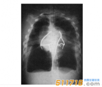 美國(guó)CIRS 602三維軀干模體